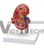 The dissection model of kidney cyst